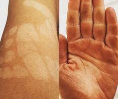 2. No More Orange Knuckles or Streaky Ankles, Just an Even Tone Built From Within